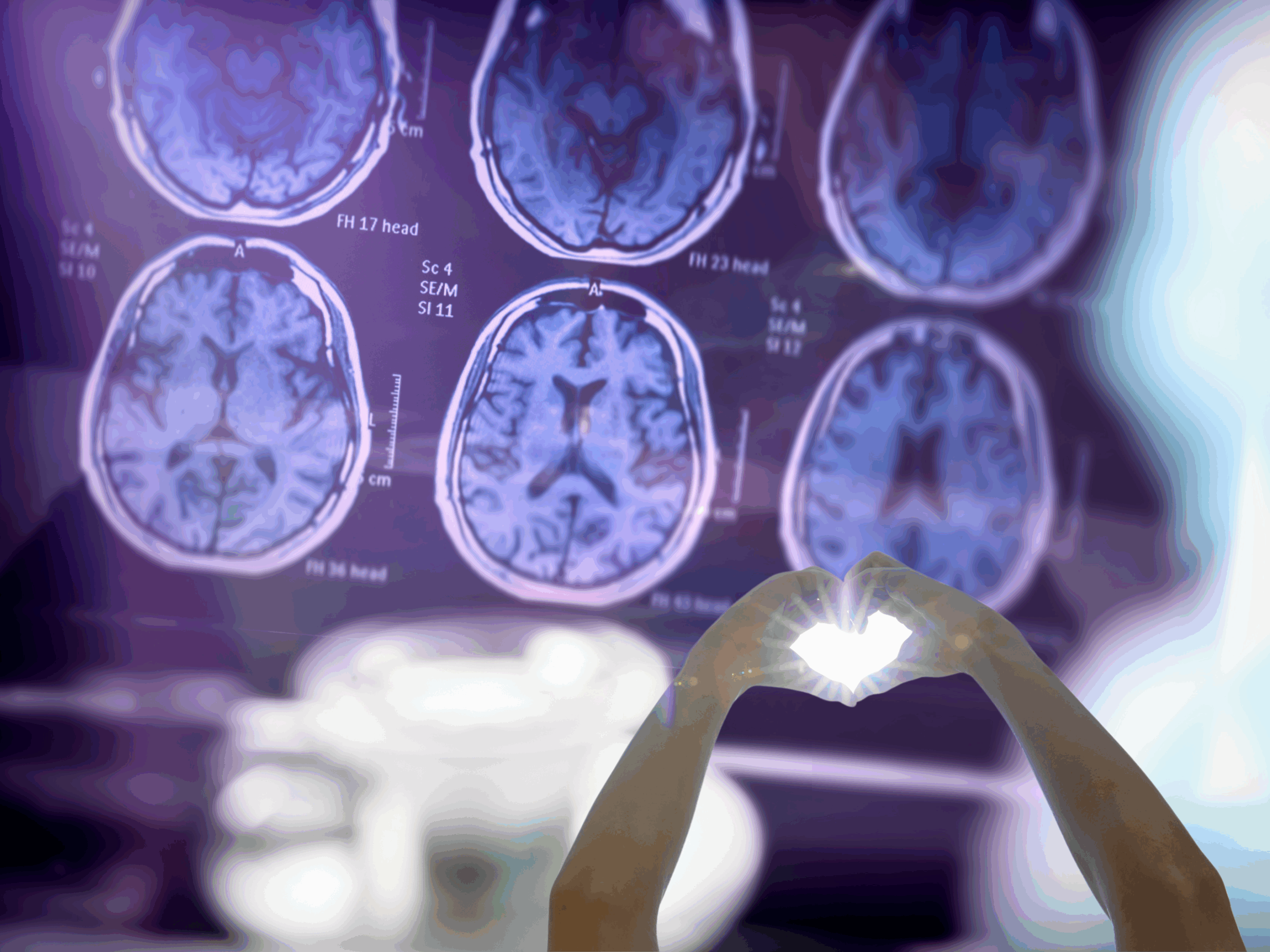 Alzheimer’s Prevention Testing: A Smarter Way to Stay Ahead of Cognitive Decline
